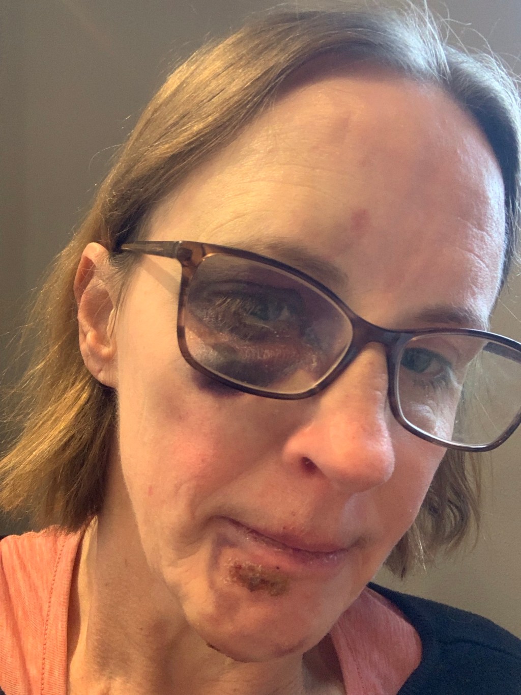 If it is broke, why won’t you fix&nbsp;it?!